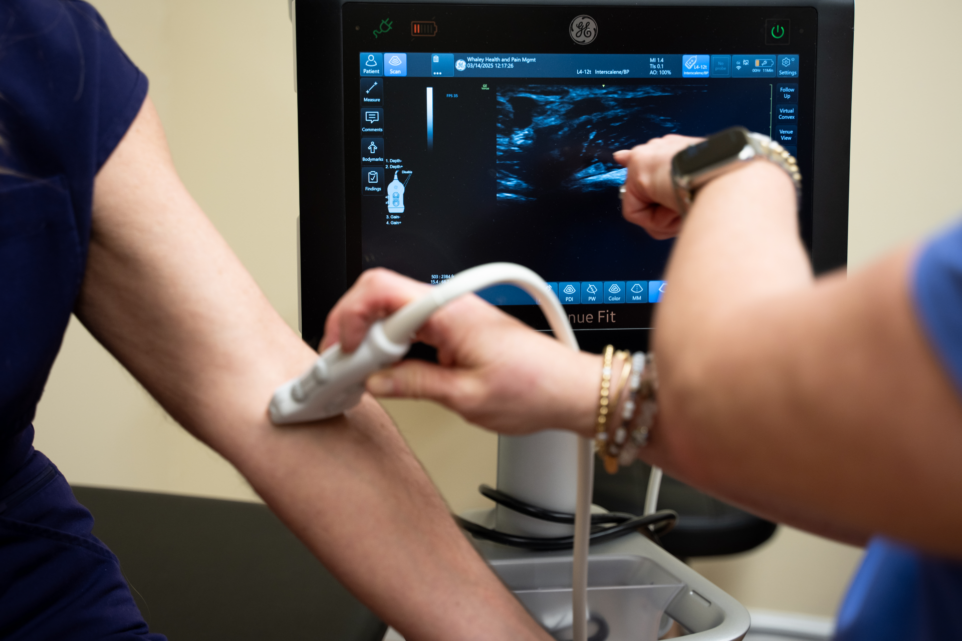 A healthcare professional uses an ultrasound probe on a patient's forearm while another person points at the live imaging on the monitor. The screen displays a detailed ultrasound scan, likely for diagnostic or pain management purposes.