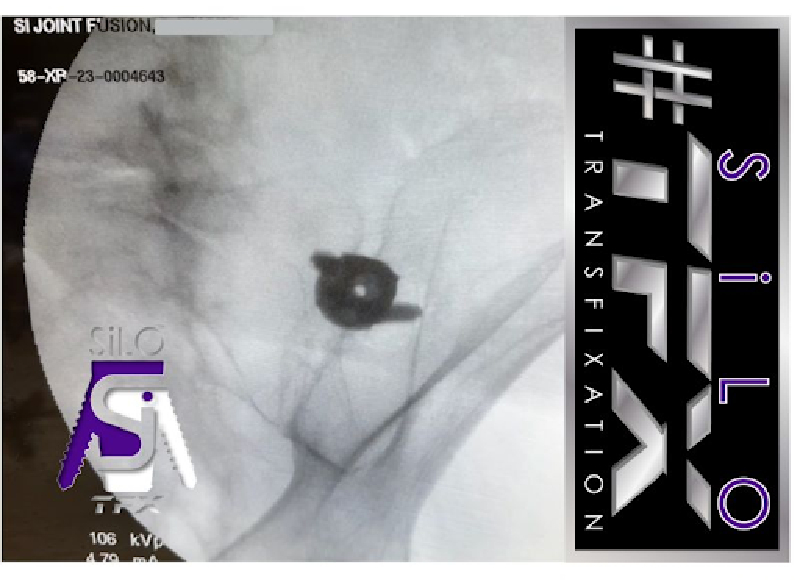 A young man with curly brown hair, wearing a blue protective vest and blue gloves, is pushing an older, fair-skinned man in a wheelchair down a hallway. Both men are smiling and giving thumbs-up gestures, suggesting a positive interaction or successful assistance.